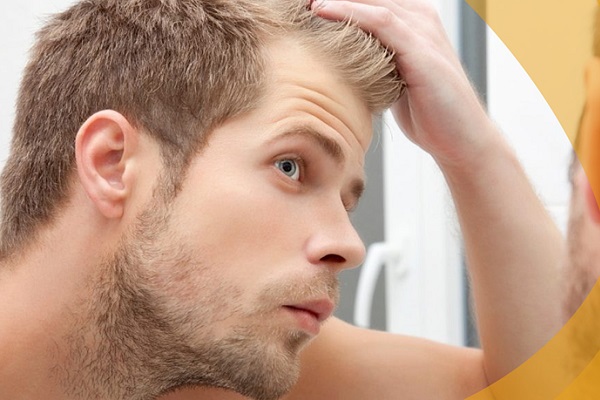 男性脱发原因是什么?