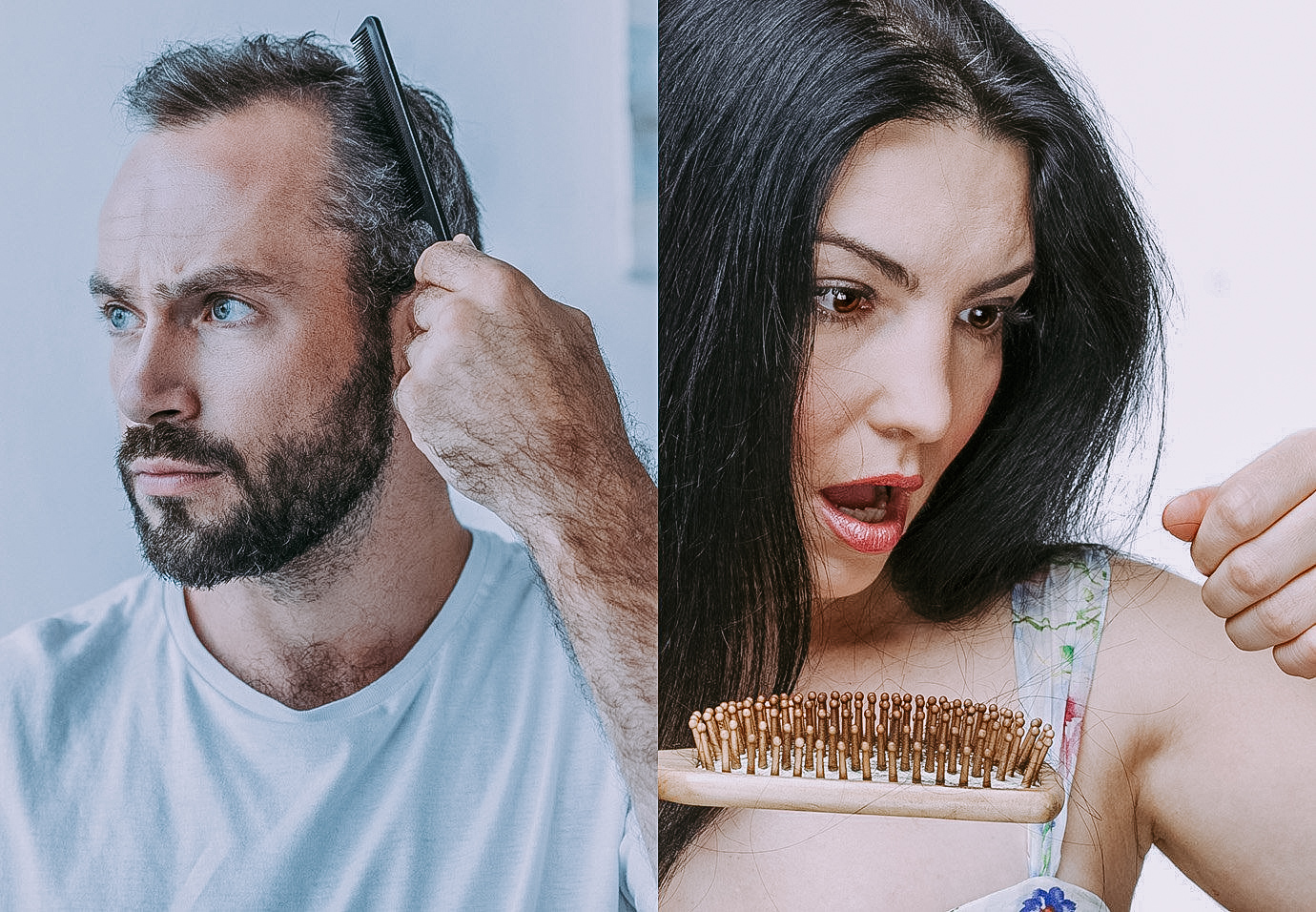 雄性脱发是什么情况怎么判断和治疗
