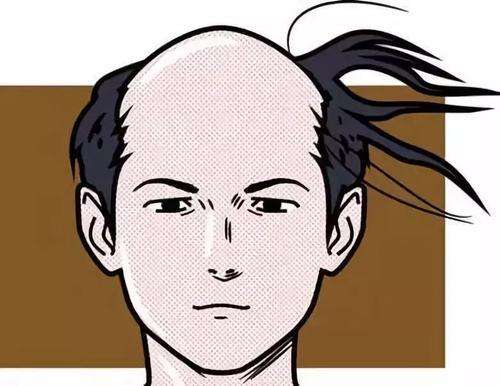 男性脱发原因 盘点男人脱发的3个原因