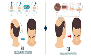 fue 和 fut 的各自利弊，看完你会选择哪一种?