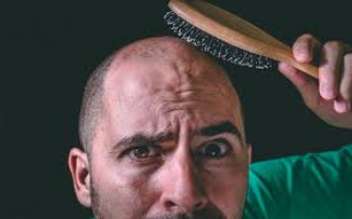 中年男性脱发怎么治疗