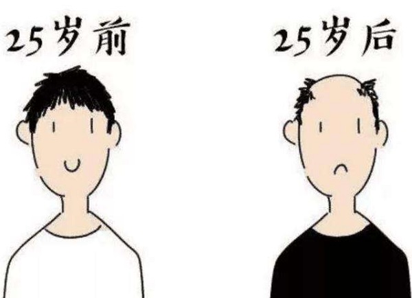 秃顶的人多吗