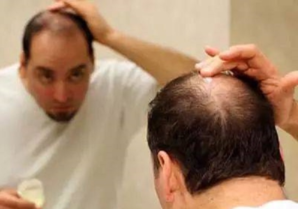 油脂性皮炎跟油脂性脱发有关系吗