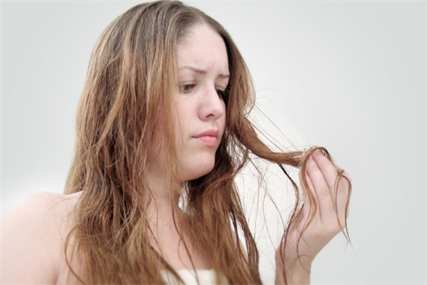 女性遗传性脱发的特征