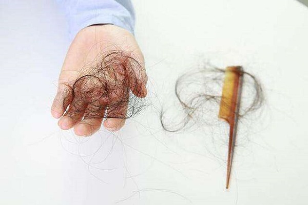 生姜治疗遗传性脱发有用吗?