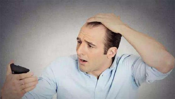 发际线高去植发有什么危害吗?