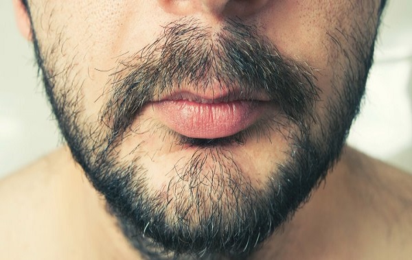 永久性植胡须可以吗?