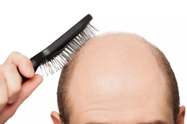 导致先天性脱发的根本原因是什么