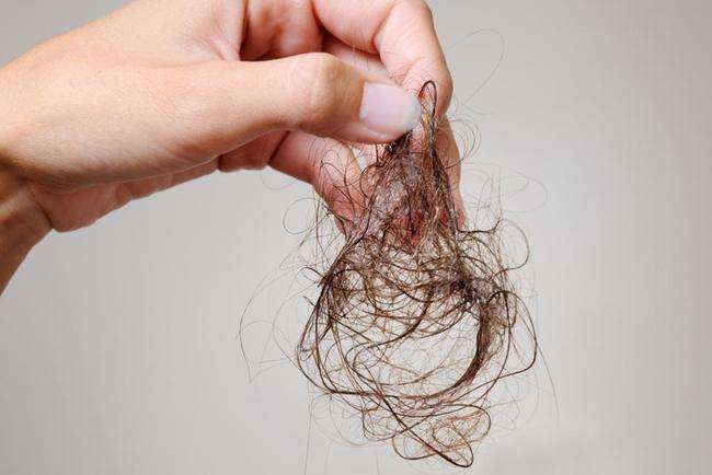 中年女性脱发是什么原因