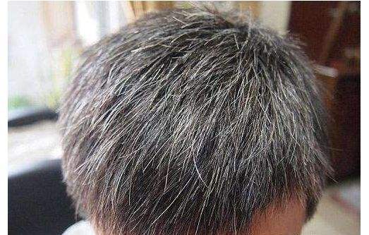 几种常见的使白发变黑的方法