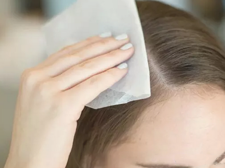 植发后，该如何正确洗头?